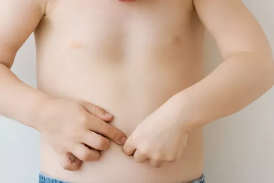 Abdominal
